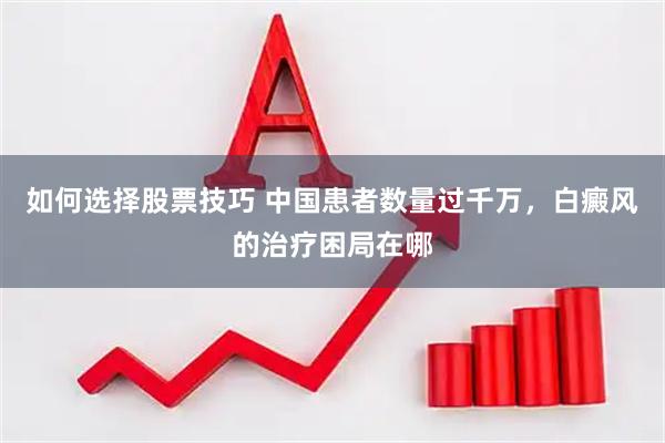 如何选择股票技巧 中国患者数量过千万，白癜风的治疗困局在哪