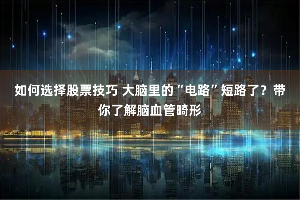 如何选择股票技巧 大脑里的“电路”短路了？带你了解脑血管畸形