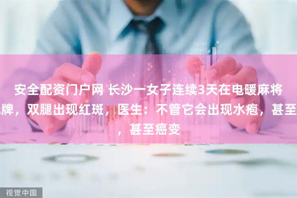 安全配资门户网 长沙一女子连续3天在电暖麻将桌玩牌，双腿出现红斑，医生：不管它会出现水疱，甚至癌变